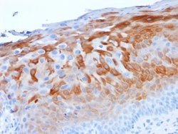 Cytokeratin 1 Antibody (LHK1) - Azide and BSA Free, Novus Biologicals 100